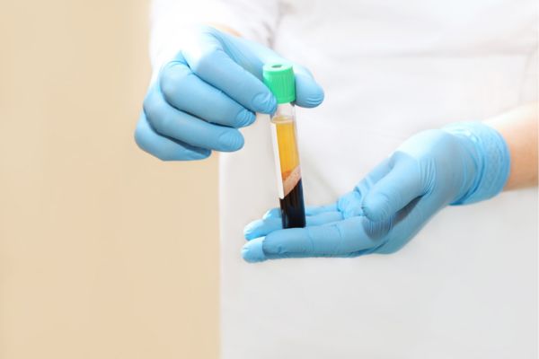 Osocze bogatopłytkowe (PRP)